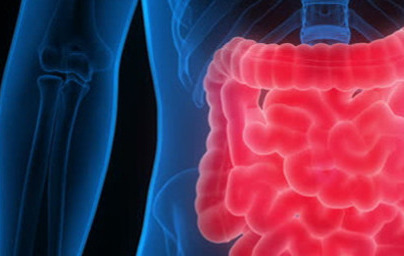 Черва Черва