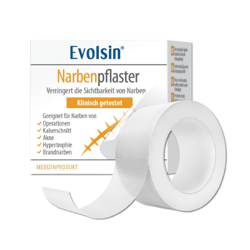 Пластир за белези – на лента, 2 см х 200 см